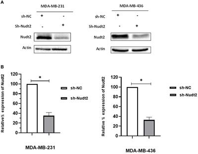 The functional role of Nudt2 in human triple negative breast cancer